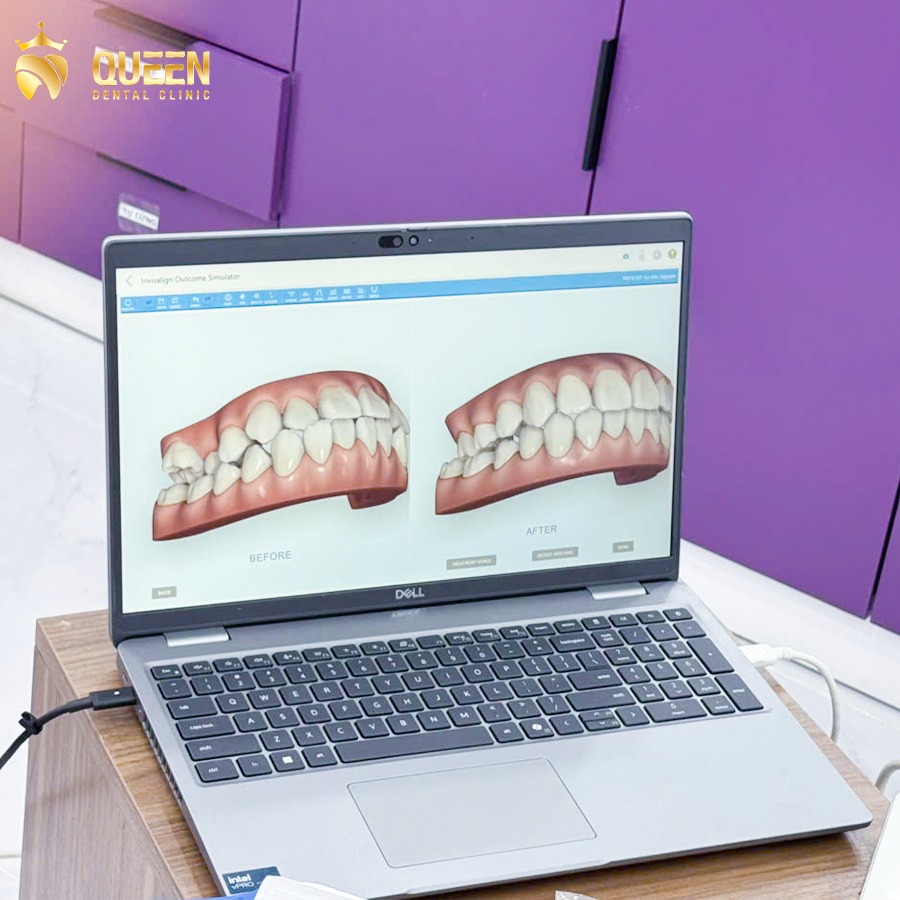 phần mềm clinCheck